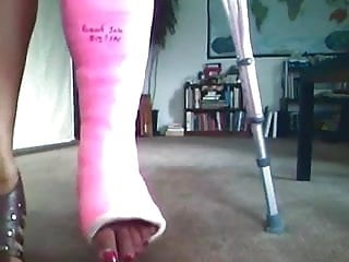 cast fetish - broken ankle