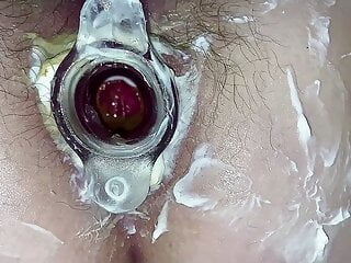 Hot Anal gaping &amp; tunnel plug. Hairy cunt &amp; asshole close-up