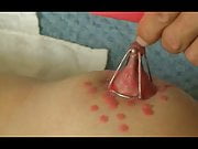 Nipple stretching and waxing