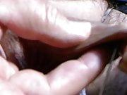 larger needle in foreskin...no pain