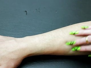 Nails Scratching Arm