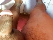 My cock after circumcision