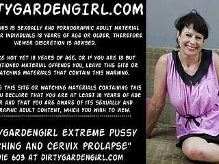 Insane cervix_and analprolapse after fisting Dirtygardengirl xnxx2 ...