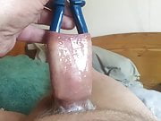 Large blue pliers in foreskin - 1 of 2 